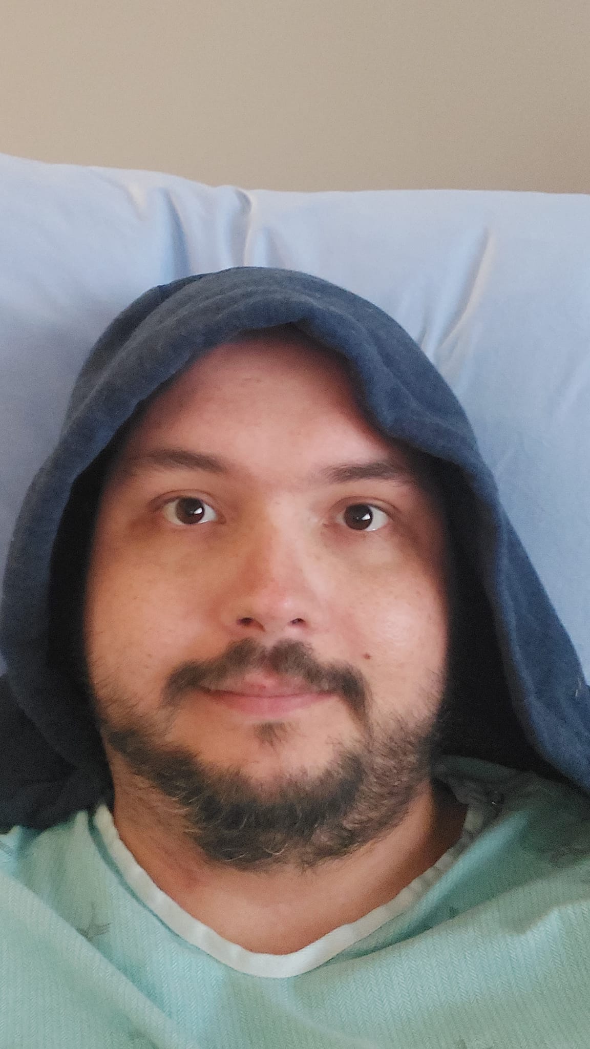 A man lies in a hospital without his glasses, he's wearing just the hood of a hoodie and hospital gowns, his beard has been cut asymetrically by the surgical team